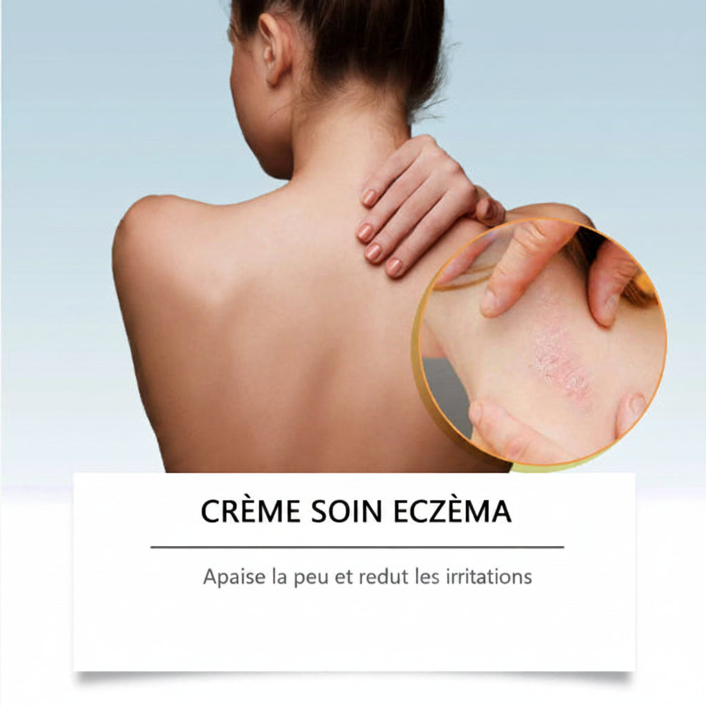 Eczema Care Cream