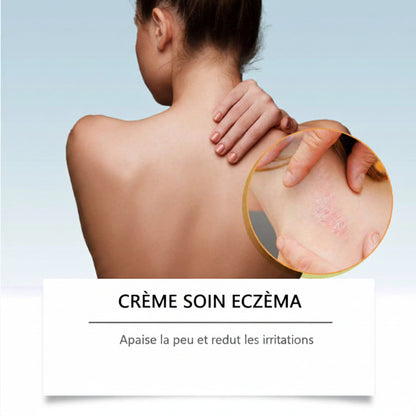 Eczema Care Cream